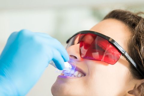 Branqueamento Dentário